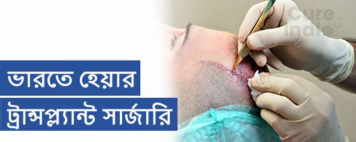 হেয়ার ট্রান্সপ্ল্যান্ট সার্জারি